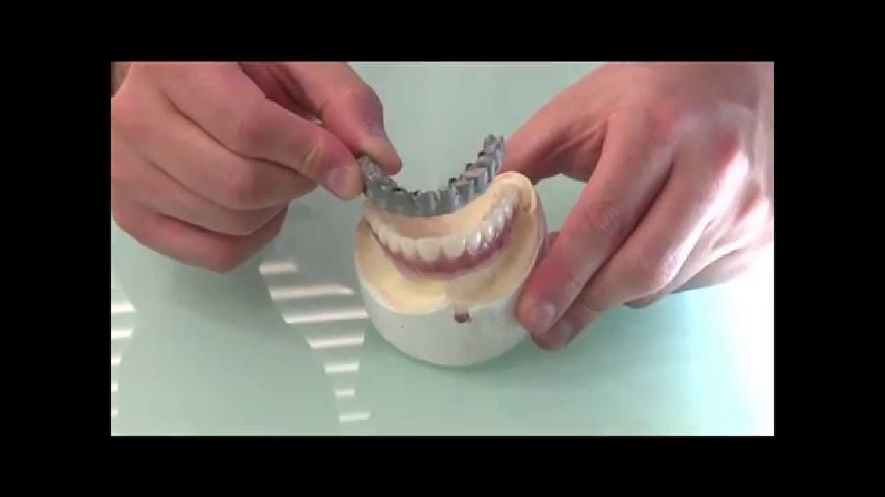 Miniatura do vídeo Implante Dentário de Todos os Dentes Materiais