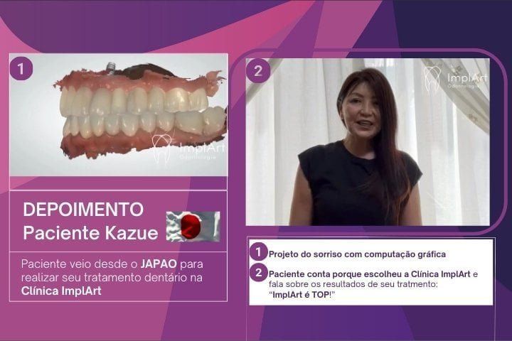 Depoimentos de Implante Dentário na Clínica Dentária ImplArt depoimentos de implante dentario