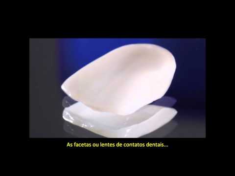 CEREC 3D - Scanner Intra Oral - ImplArt Odontologia