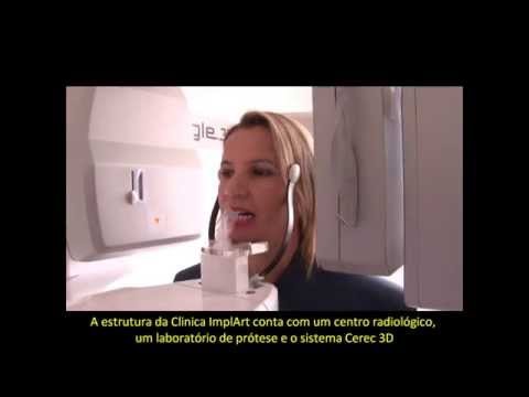 Day Clinic Odontológico - Clínica ImplArt Spa Odontologia