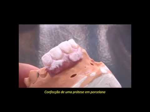 Laboratório de Prótese Dentária Dentro da Clínica ImplArt em São Paulo