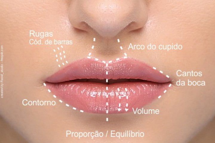 preenchimento labial dentista 47kb 1e7543d6