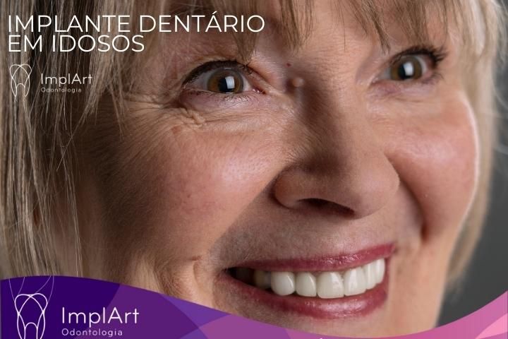 implante dentario em idosos