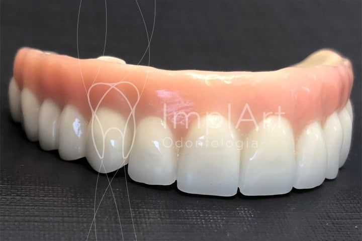 protese zirconia implart 49kb 399e2da9