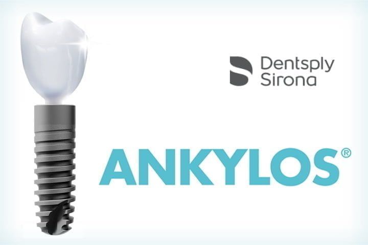 implante ankylos dentsply 50kb 3fa96205