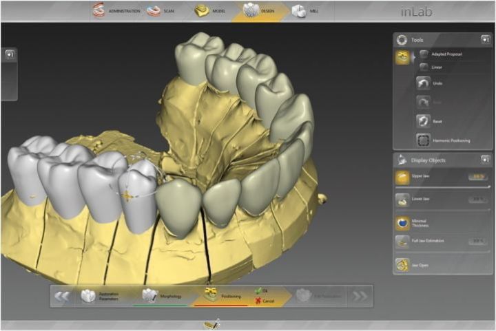 cerec sirona inlab implart 50kb 40f7604a