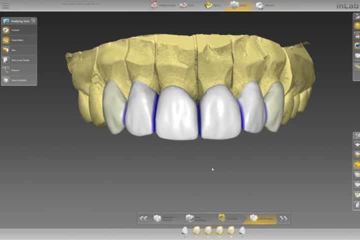 coroa projeto emax 50kb 8f9efd13