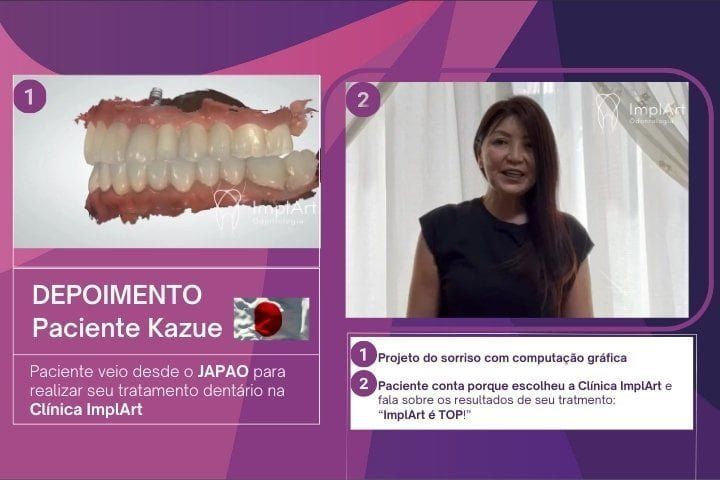 depoimentos de implante dentario