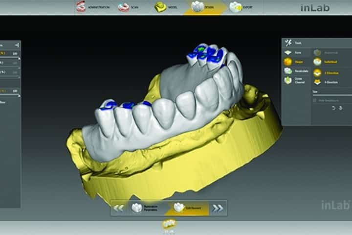 projetando protese total computador 50kb 92ac3d62