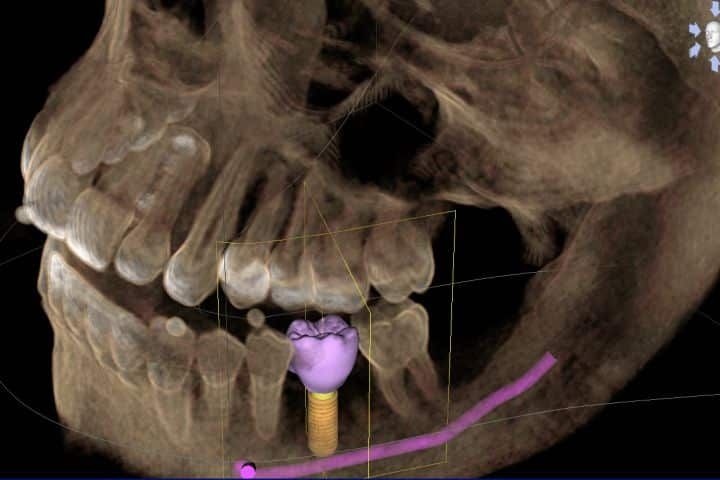 tomografia radiologia digital 50kb aca0cabe