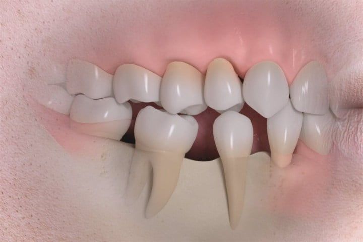 ma oclusao dentaria 50kb b5715d63