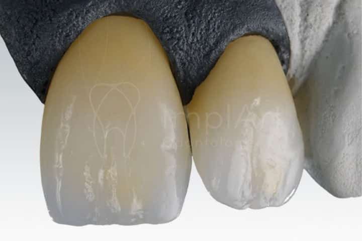 zirconia cubica translucida fx 50kb ffda7b34