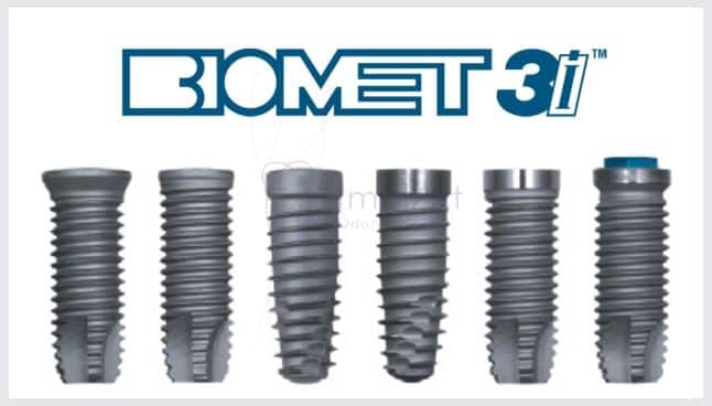 Tecnologia Dos Implantes 3i ImplArt