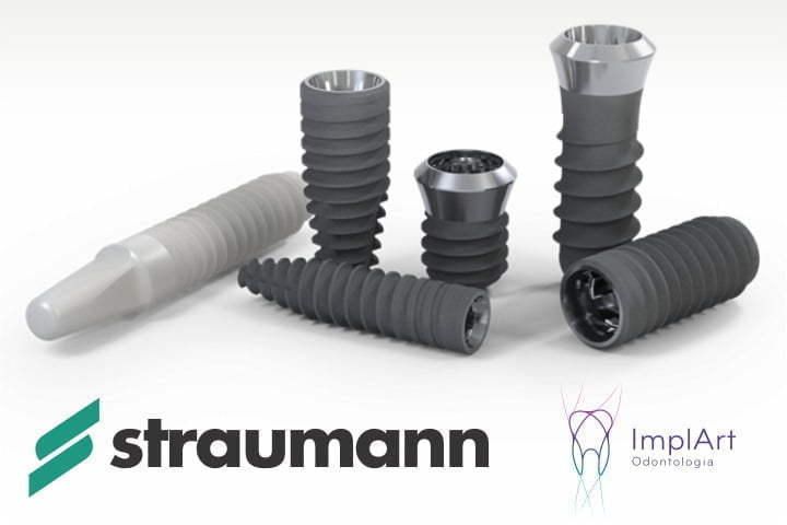 melhores implantes straumann 50kb