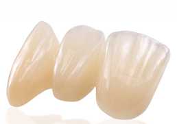 coroa dental de porcelana estética