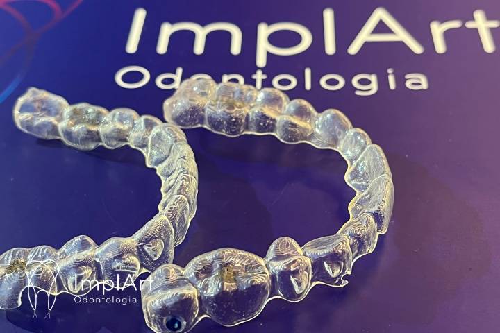 ALINHADOR ORTODONTICO INVISALIGN