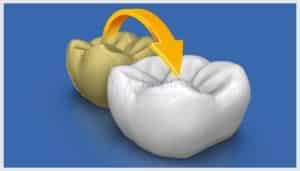 cerec copia