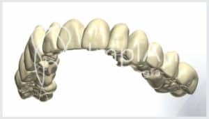 planejamento reabilitacao oral 26kb