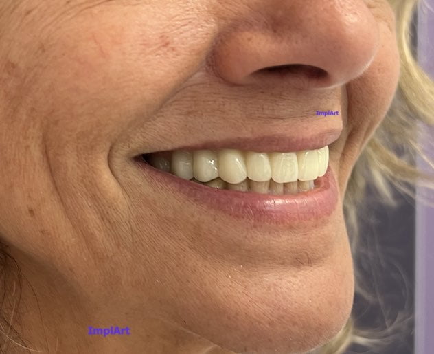 protocolo dentario como é feito