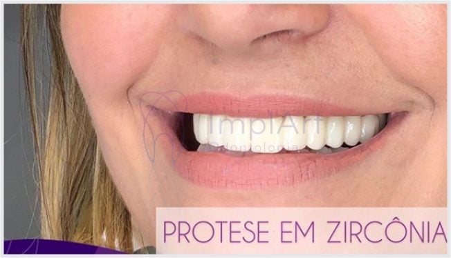 protese_zirconia_implante_35kb