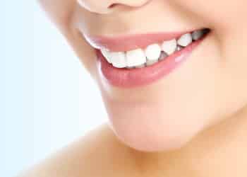 estetica dental lente de contato