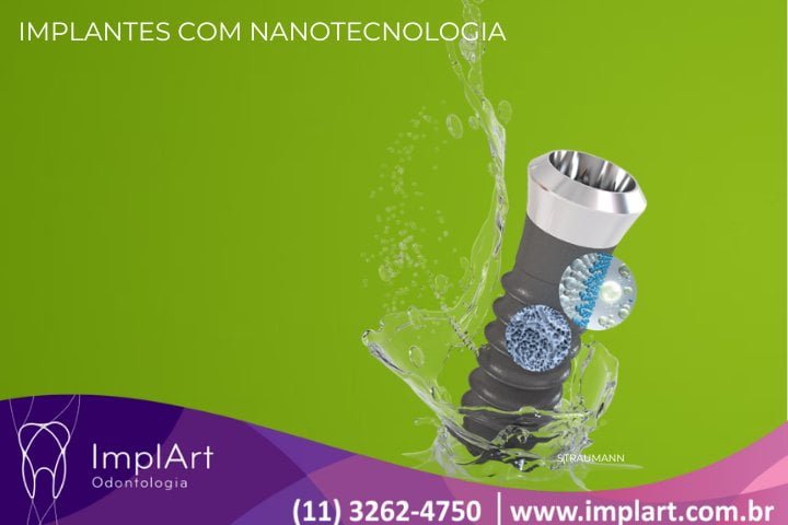 IMPLANTES COM NANOTECNOLOGIA