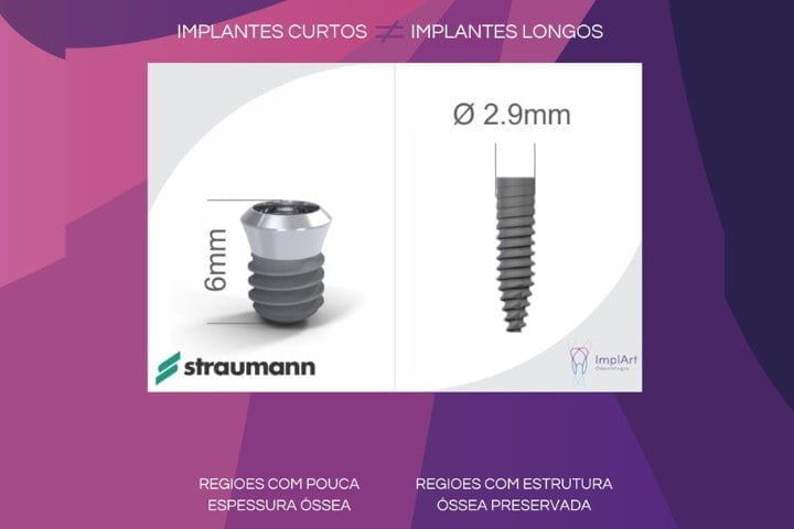 implante dentario curto