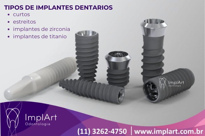 tipos de implantes dentarios