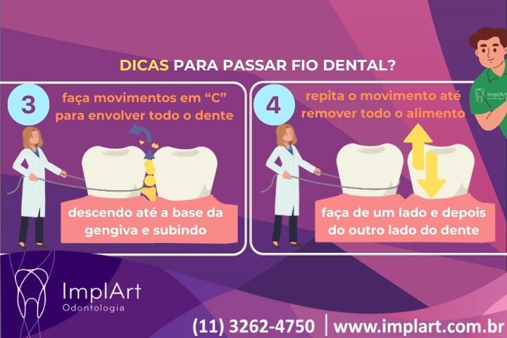 como evitar a perda dentaria e os implantes 2