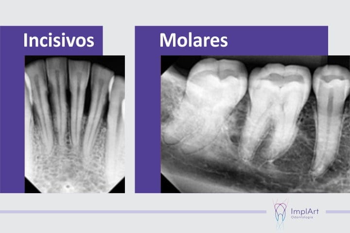 radiografia periapical vatech 50kb