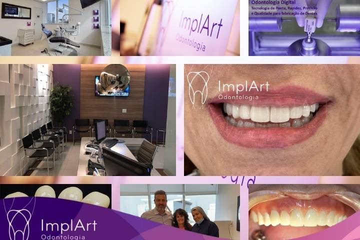 implantes dentarios em idosos na Clinica ImplArt