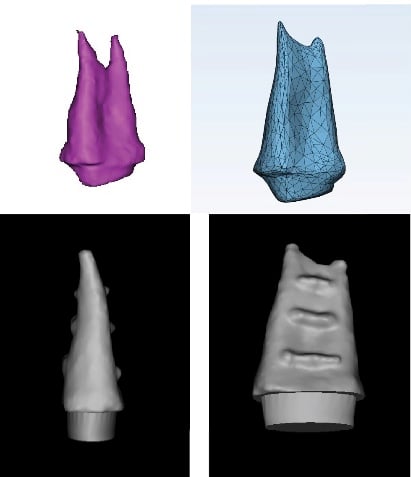 IAR root analog implant