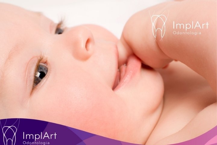frenectomia bebe