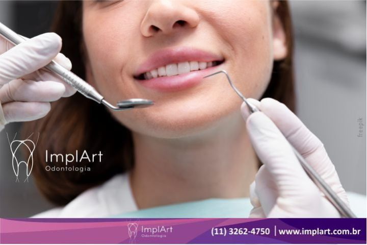 Pre- and post-operative care of dental implants care of dental implants