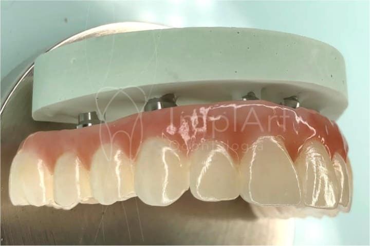 Digital dental laboratory within the ImplArt Clinic Dental laboratory