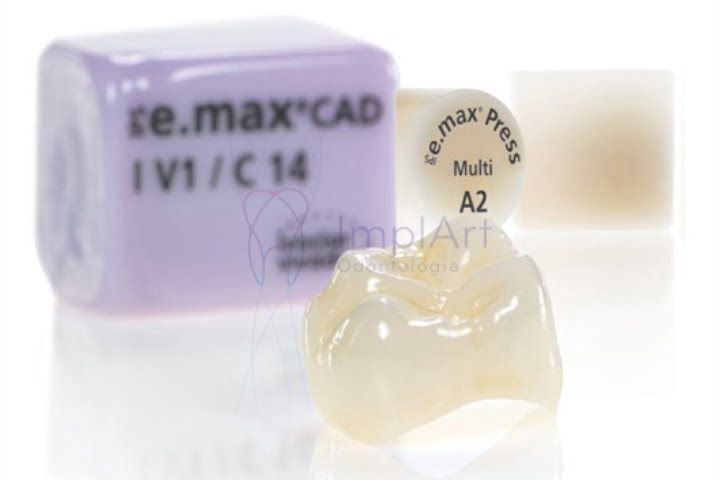 Pure porcelain Emax crown for highly aesthetic implants pure porcelain