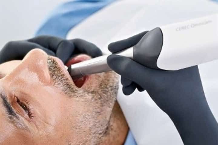 Cerec 3D - Scanner intra oral cerec